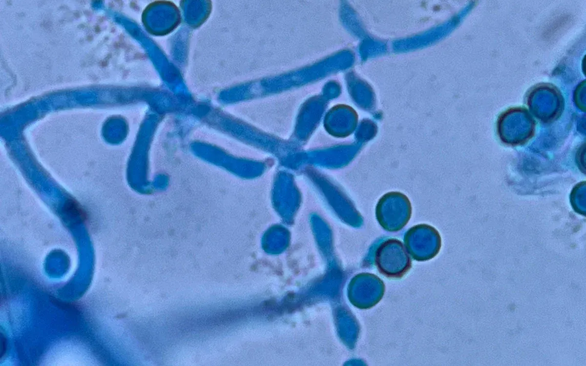 Rhizobacteria og Trichoderma